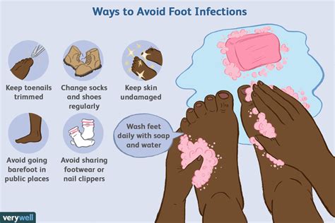 What does bacteria on feet look like?