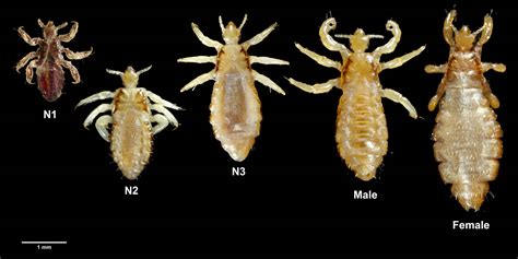 What does body lice look like?