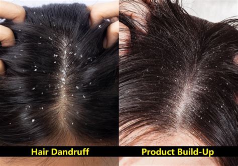 What does build up on hair look like?