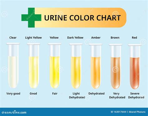 What does diabetic urine look like?