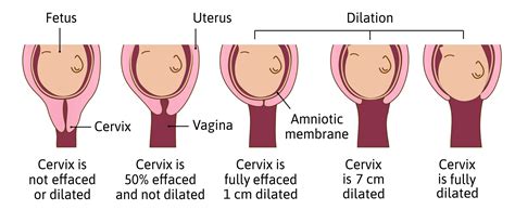 What does dilation feel like?