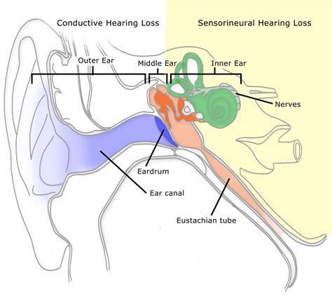 What does ear imbalance feel like?