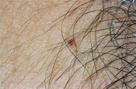 What does first pubic hair look like?