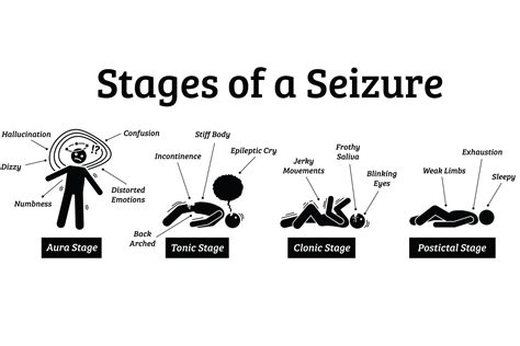 What does it feel like before a seizure?