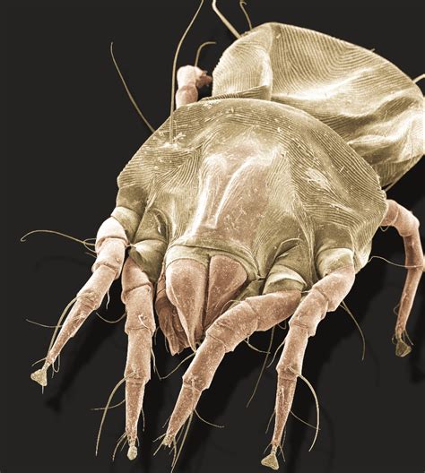What does it feel like to have mites?