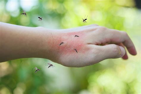 What does it mean if mosquitoes bite you a lot?