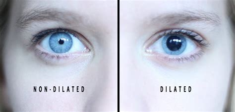 What does it mean when a girl has dilated pupils?