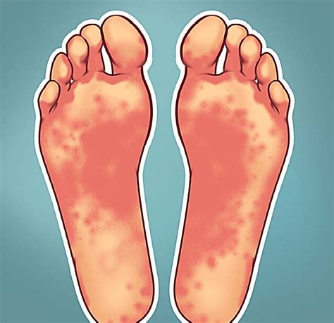 What does it mean when the bottom of your feet change color?
