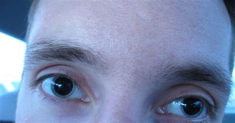 What does it mean when your pupils get big?