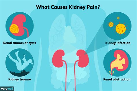 What does kidney pain feel like?