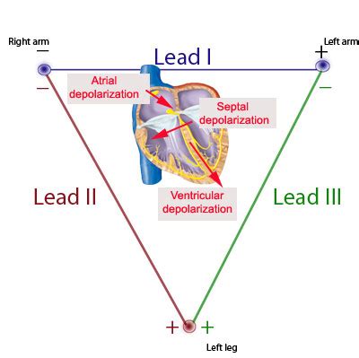 What does lead 3 represent on an ECG?