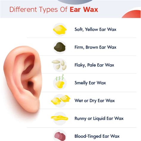 What does lots of wet earwax mean?