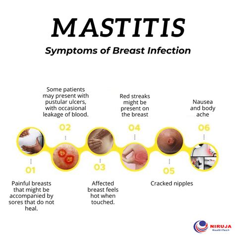 What does mastitis look like?