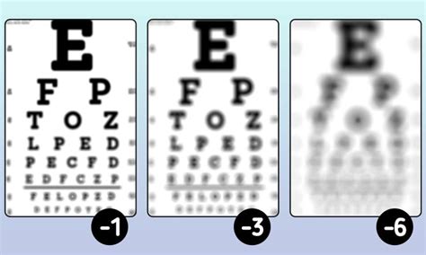 What does minus 2 vision look like?