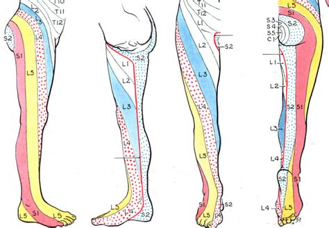 What does nerve pain from L5 S1 feel like?