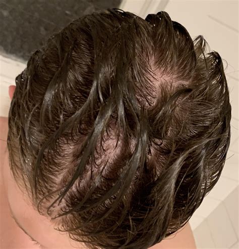 What does normal hair look like when wet?