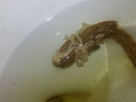 What does parasites look like in poop?