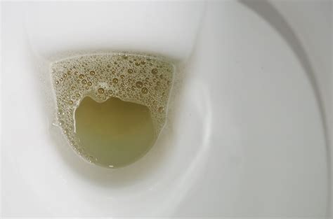 What does pee look like with kidney problem?