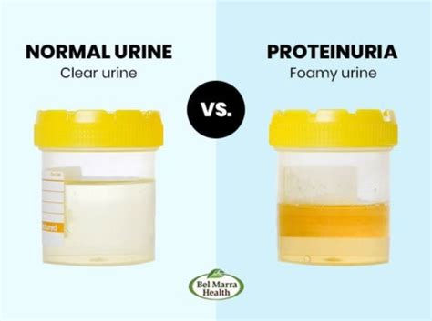 What does protein in urine look like?