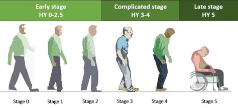 What does stage 1 Parkinson's look like?