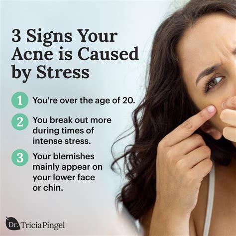 What does stress acne look like?