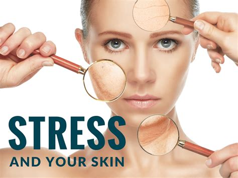 What does stressed skin look like?