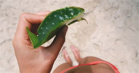 What does sunburned aloe vera look like?