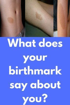 What does the birthmark symbolize quotes?