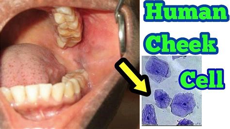 What does the inside of a healthy cheek look like?