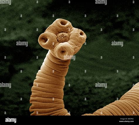 What does the mouth of a tapeworm look like?
