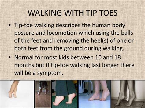 What does toe walking look like in adults?