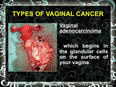 What does vaginal cancer look like?