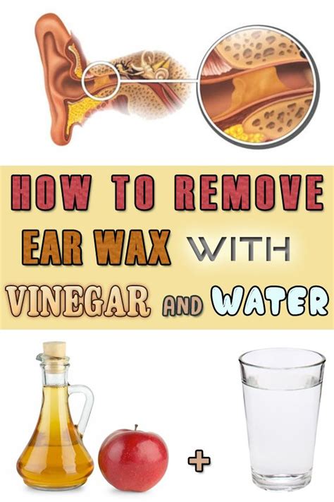 What does vinegar do to wax?