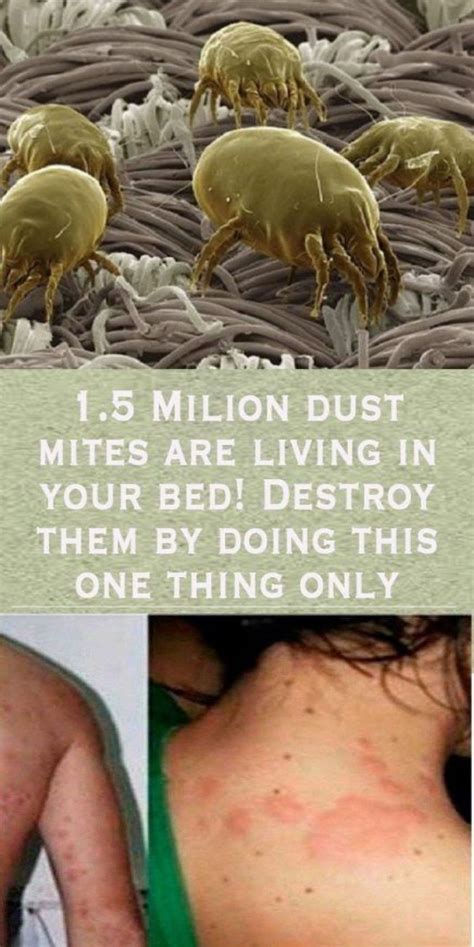 What does your skin look like if you have mites?