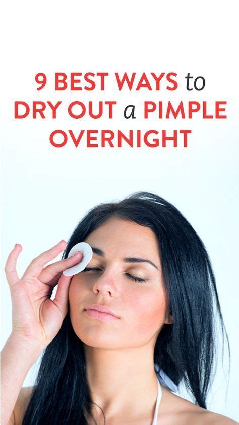 What dries out pimples overnight?