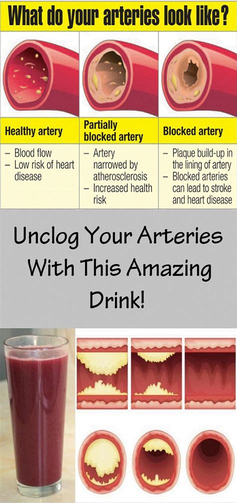 What drink opens up arteries?