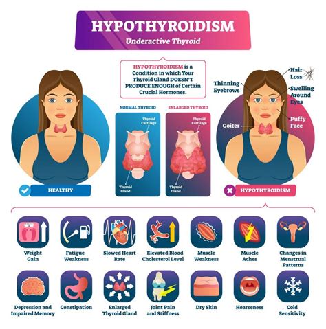 What emotion is linked to thyroid?