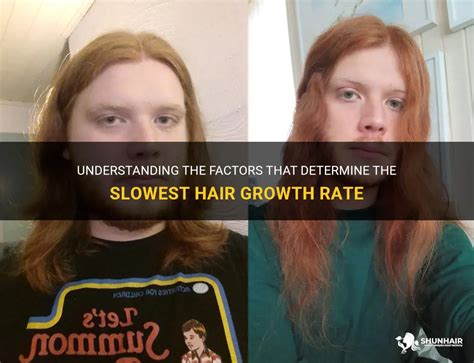 What ethnicity has the slowest hair growth?