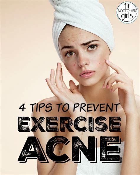 What exercises reduce acne?