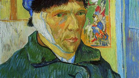 What eye disease did Van Gogh have?