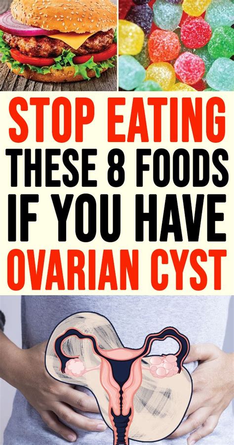 What foods are bad for cysts?