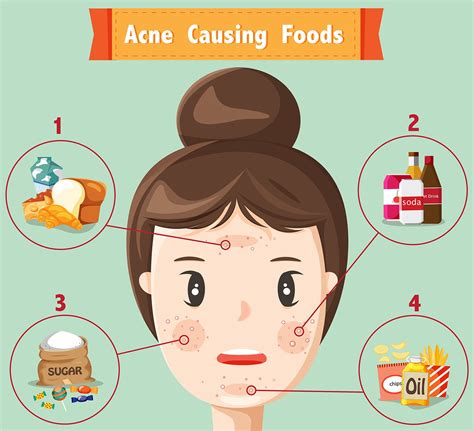 What foods cause acne?