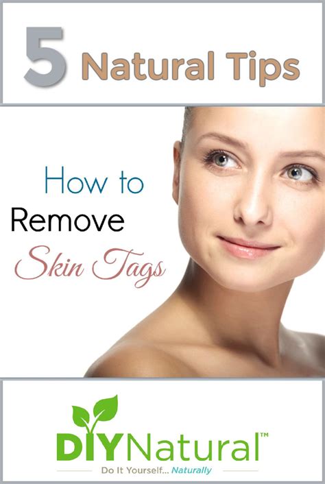 What foods get rid of skin tags?