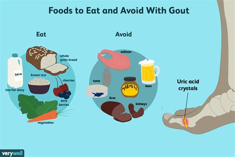 What foods help clear up gout?