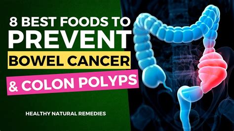 What foods reduce colon polyps?