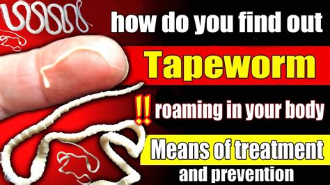 What foods should you avoid if you have tapeworms?