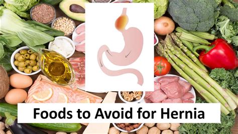What foods shrink a hernia?