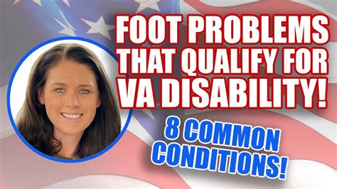 What foot problems qualify for Social Security disability?