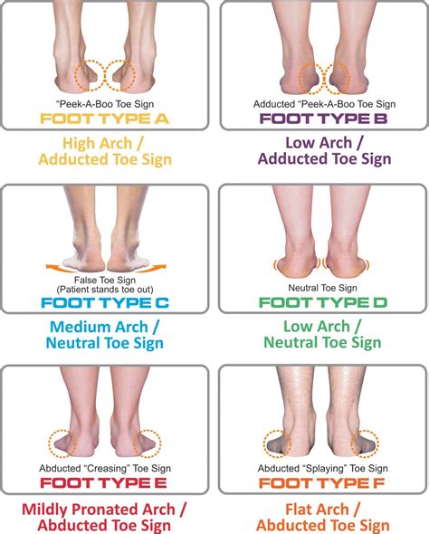 What foot type am i?