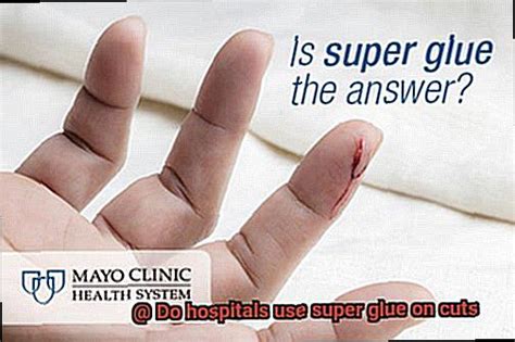 What glue do hospitals use for cuts?